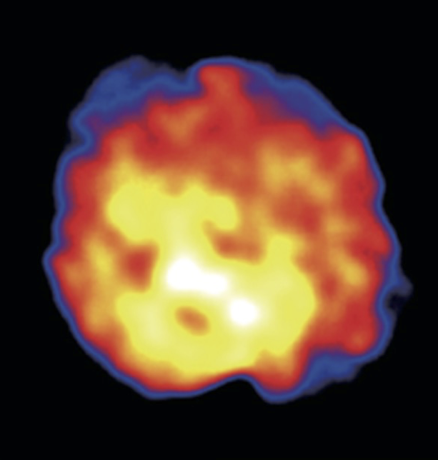 SN1006の非対称性爆発の研究成果